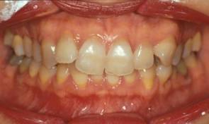 Immagine clinica: Ortodonzia