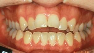 Immagine clinica: Ortodonzia