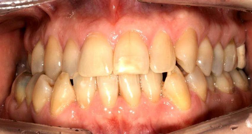 Immagine clinica: Ortodonzia